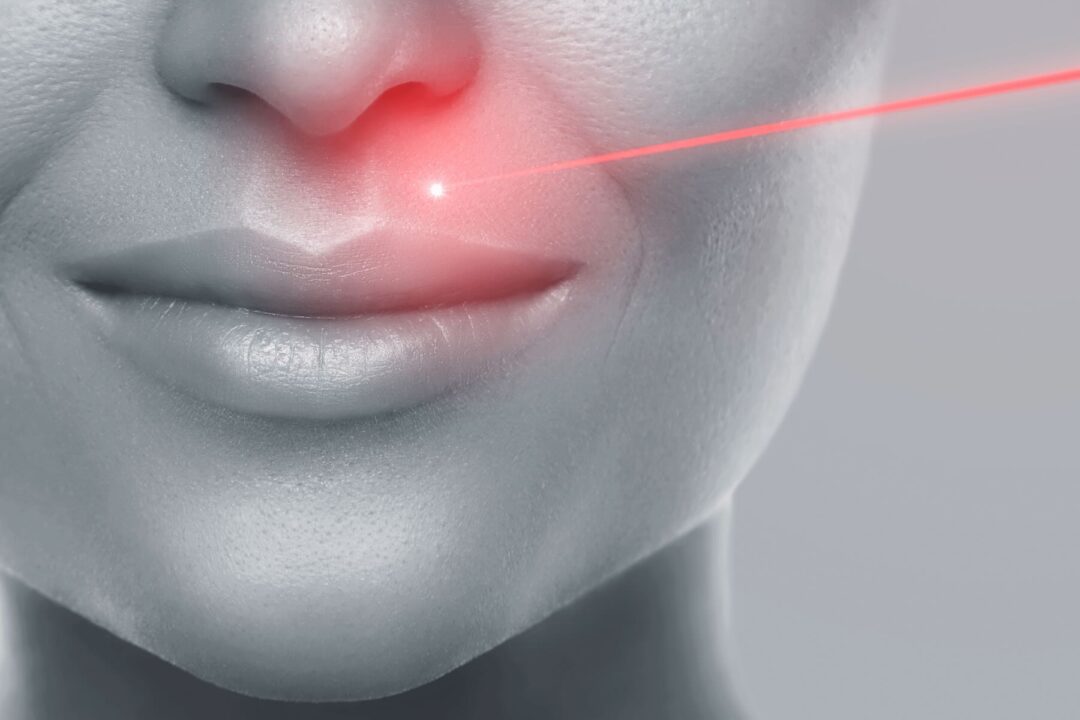 Epilazione Laser diodo Corsico